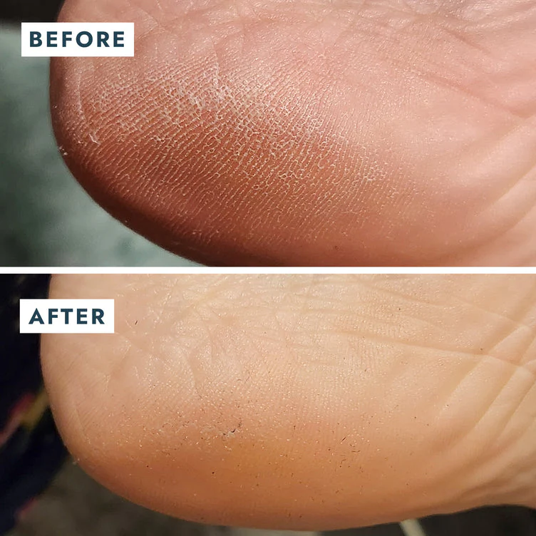 VOESH Heel Repair Duo - Repair Balm + Heel Socks - Image 5
