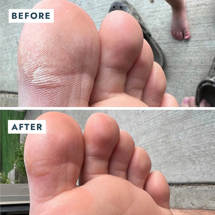 VOESH Heel Repair Duo - Repair Balm + Heel Socks - Image 6